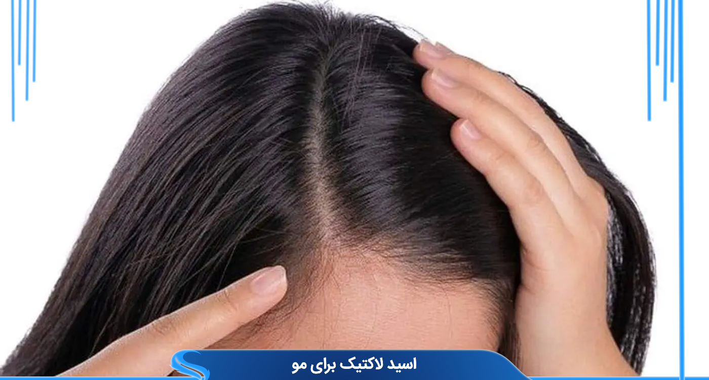  اسید لاکتیک برای مو